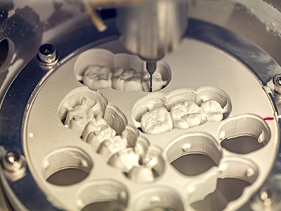 ValleyWide Dental | Periodontal Treatment, Teeth Whitening and Preventative Program