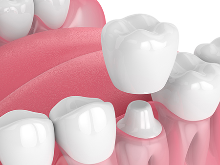 ValleyWide Dental