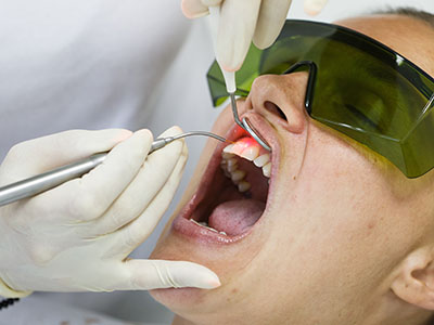 ValleyWide Dental | Full Mouth Rejuvenation, Dermal Fillers and Snoring Appliances