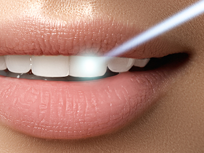 ValleyWide Dental | Emergency Treatment, Sedation Dentistry and E4D